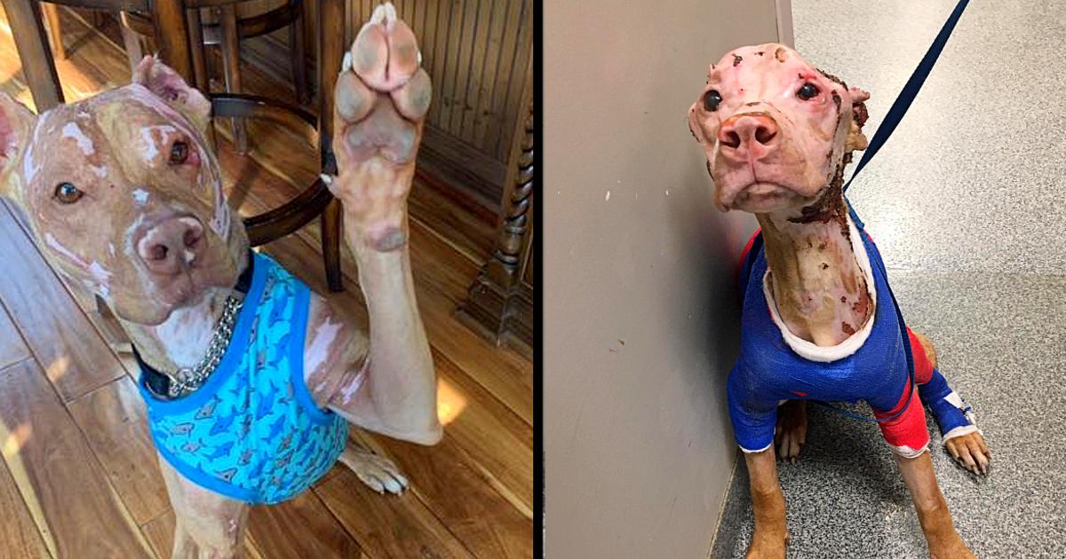 Severely Burned Pitbull Defied The Odds And Now He Loves Life